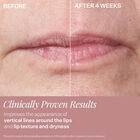 Double Fix™ for Lips Plumping & Vertical Line Treatment, , hi-res